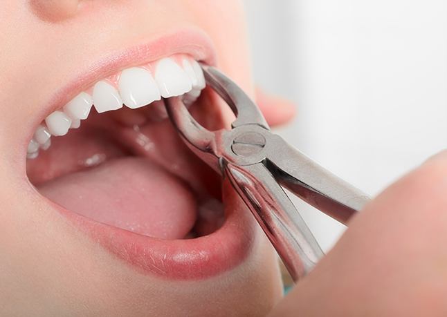 Tooth held in forceps